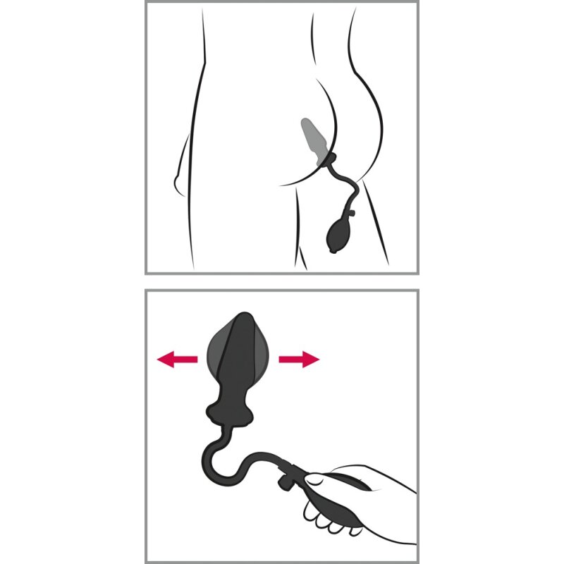 Anal Expert